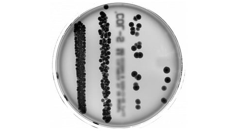 Our microbiome influences a great number of processes in the human body. A recent study shows that the liver's regenerative capacity is overridden when the microbiome is disturbed – for example, by antibiotics.
