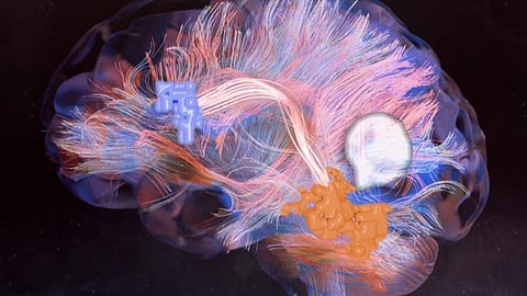 Neurosurgeons developed an AI-based diagnostic screening system called DeepGlioma that uses rapid imaging to analyze tumor specimens taken during an operation and detect genetic mutations more rapidly.