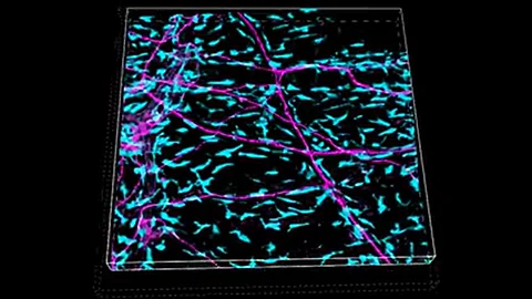 Shown here are pain receptors in the brain’s protective layers, known as meninges. When activated by bacteria, pain receptors release a chemical that disables the normal protective functions of immune cells known as macrophages, weakening the brain’s defenses.