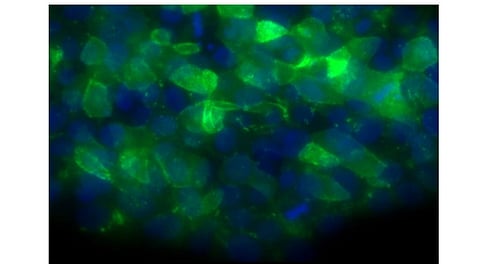 Shown are human embryonic stem cells engineered to have a mutation that causes poikiloderma with neutropenia, a bone marrow failure syndrome that increases a patient's risk of developing dangerous infections.