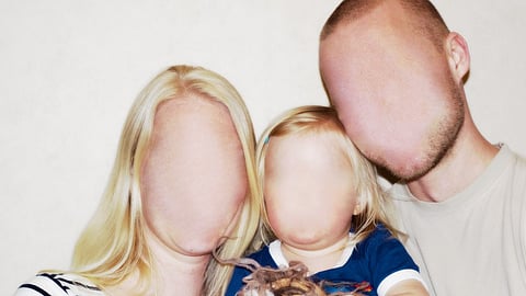 As many as 1 in 33 people may meet the criteria for face blindness: 1 in 108 have major prosopagnosia whereas 1 in 47 have mild prosopagnosia.