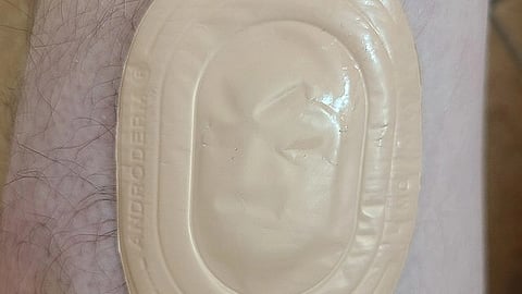 The patch can be attached to the skin, allowing the vaccine to dissolve without the need for a traditional injection.