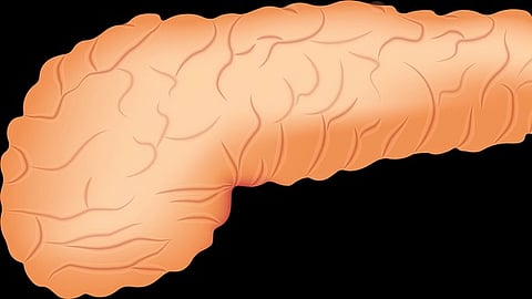 The charge of the helper lipid might affect the targeting of the nanoparticle and direct it towards the pancreas