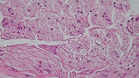 Collagen fibers are durable, elastic, and also serve as signals that determine the cell’s so-called destiny, in medicine they are used as an environment to accelerate growth and differentiation of tissues