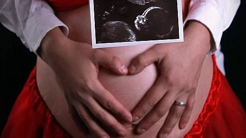 Cardiovascular disease is the primary cause of maternal deaths related to pregnancy in high-income countries