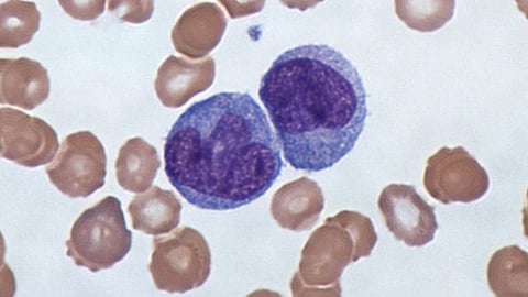 Monocytes are short-lived circulating immune cells that are a precursor to macrophages, immune cells able to engulf and destroy viruses, bacteria and other cells foreign to the host.