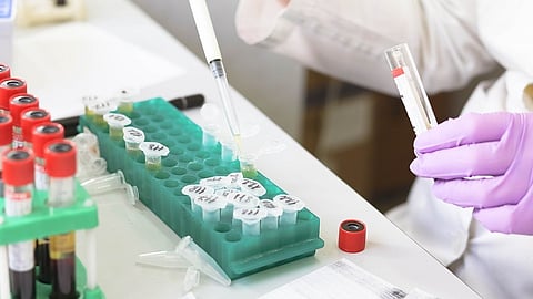 The tests in use now are focused on diagnosing women and involve a vaginal swab.