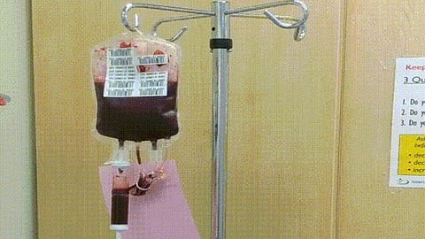 One litre of blood from each participant is removed and converted into liquid plasma, red blood cells, white blood cells, and platelets via a high-tech machine.