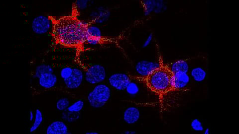 The neurons play a key role in voluntary movement, and the death of these neurons is a hallmark of Parkinson’s.