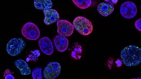 Plasma cells are a distinct variety of leukocytes that perform a crucial function in the immune system by creating vital antibodies in the lymph nodes and bone marrow.