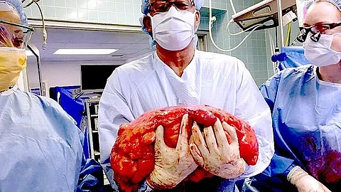Tumor margins are evaluated by pathologists after the tumor has been removed from the patient’s cavity by surgeons.
