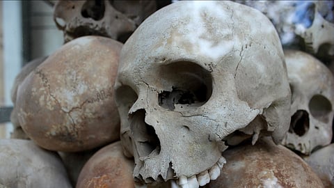 Nazi doctors carried out up to 30 painful and often deadly experiments on concentration camp prisoners without their consent. (Representational Image: Pixabay)