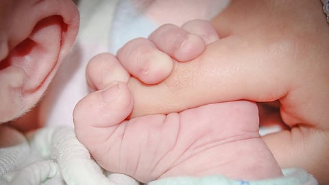 According to medical professionals, roughly 1 in every 1 million live newborns have unusual birth defects including having extra organs or limbs, commonly known as polymelia. (Representational image: Pixabay)