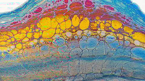 Blocking the function of IL-17 reduces the pro-inflammatory state and delays the appearance of age-related features in the skin (Representational image: Unplash).
