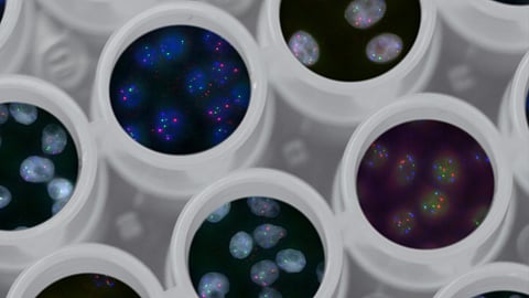 A new study from Washington University School of Medicine in St. Louis shows how prostate cancer creates its own hormonal fuel supply in response to anti-testosterone therapy (Representational image: Unplash).