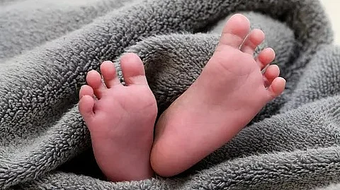 Genetic alterations that affect organ development during pregnancy, the condition is marked by defects in formation of the diaphragm
(Unsplash)
