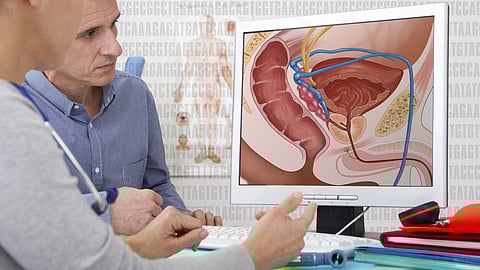 An international team of scientists led by UniSA Professor of Molecular Medicine Doug Brooks has made the breakthrough, which assists pathologists when visualising prostate cancer in patient tissue samples. (Wikimedia commons)