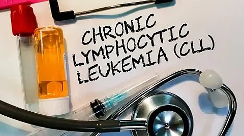 Chronic Lymphocytic Leukemia(CLL) patients are being resistant to existing treatment requiring new therapy options.(Unsplash)