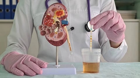 A new biomarker from the kidney found via a simple urine test can be used to diagnose Acute Interstitial Nephritis (AIN)(Unsplash)
