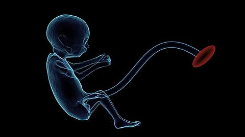 In Uttar Pradesh, the seven-month-old infant was suffering from a rare condition called foetus in fetu for which underwent surgery. (Representational Image: Wikimedia Commons)