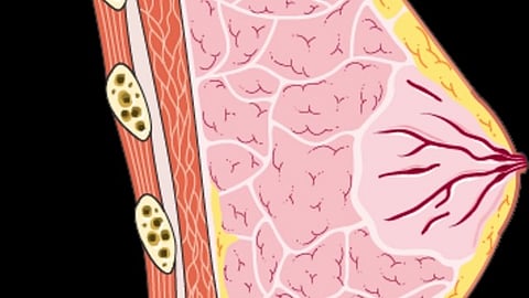 Race/ethnicity is not an independent predictor of hospital readmission in patients undergoing breast reconstruction surgery, reports a study in the August issue of Plastic and Reconstructive Surgery (Wikimedia Commons)