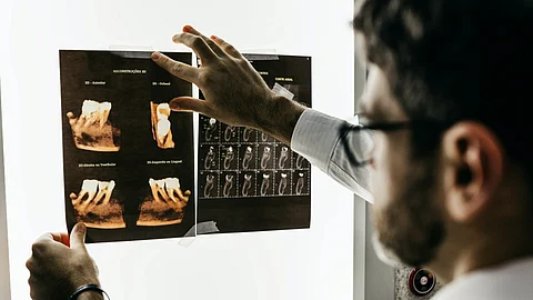 SLAC Researchers Make Breakthrough in X-Ray Laser Technology (Representational Image: Unsplash)