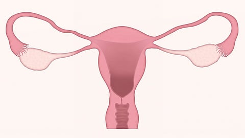 The American Cancer Society estimates for ovarian cancer in the United States for 2023 are:
About 19,710 women will receive a new diagnosis of ovarian cancer.
About 13,270 women will die from ovarian cancer. (Pixabay)