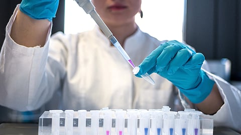 Enzyme's secrets revealed in first-ever images (Representational Image: Unsplash)