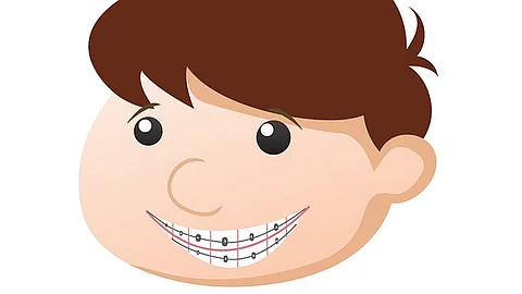 The oral microbiome is a complex ecosystem that is essential for maintaining oral health and lung health (Pixabay)