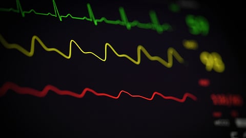 Heart disease may rise again unless Americans modify major risk factors. (Unsplash)