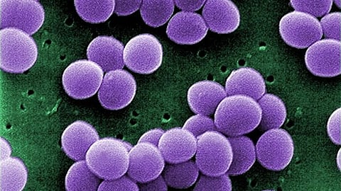 Scanning electron micrograph (SEM) shows a strain of Staphylococcus aureus bacteria. (Representational Image: Wikimedia Commons)
