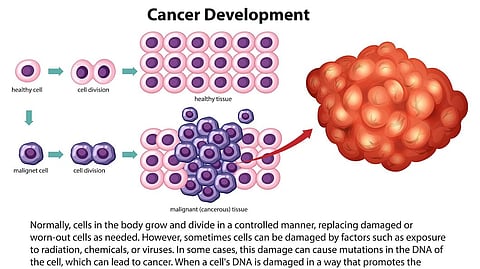 Visual representation of development of cancer cells
