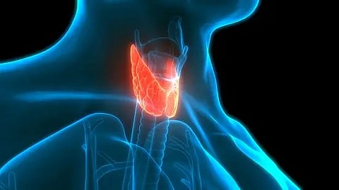 Adding Immune Modulator To Targeted Therapy Does Not Improve Survival In Difficult-To-Treat Thyroid Cancer (Representational Image: Unsplash)