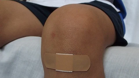 Doctors often struggle to accurately identify infected wounds, as clinical signs and traditional diagnostic methods can be imprecise and time-consuming (Representational Image: Pixabay)