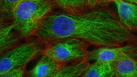 Triple-negative breast cancer, or TNBC, affects 10-15% of patients with breast cancer in the US (Representational Image: Unsplash)