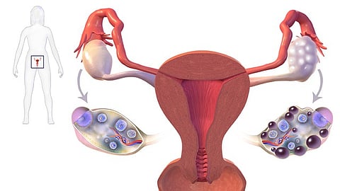 Diagram of the female reproductive system, highlighting organs such as ovaries, fallopian tubes, uterus, and vagina.