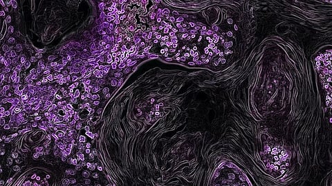 When times are tough, liver cells come together and share molecules needed to multiply; cancer cells may also do this to resist treatment. (Representational Image: Unsplash)
