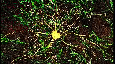 Striatal neuron in an interneuron cage (Representational Image: Wikimedia commons)
