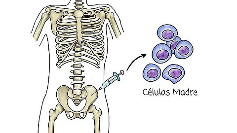 Internet calls US doctor a "real hero" after he donates bone marrow to save patient's life (Representational Image: Wikimedia Commons)