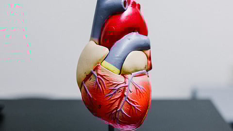 The American Heart Association defines the overlap in kidney disease, Type 2 diabetes and obesity as cardiovascular-kidney-metabolic (CKM) syndrome. (Representational Image: Unsplash)