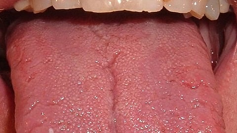 It’s our sense of taste that pulls us back from the brink of food inhalation on a hungry day. Stimulated by the perception of flavor, a set of neurons – a type of brain cell – leaps to attention almost immediately to curtail our food intake.
(Representational image: Wikimedia commons)