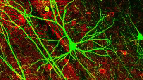 The team applied LCD-eGRASP (local circuit dual-eGRASP) technology to identify the local synaptic connections between inhibitory interneurons and engram cells, shedding light on the role of inhibitory interneurons in memory expression.
(Representational image: Wikimedia Commons)