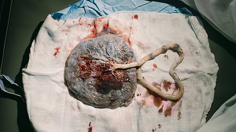 By pumping fluids through the model, researchers can test how substances such as medicines and nutrients cross the placental barrier from mother to fetus and vice versa.
(Representational Image: Unsplash)