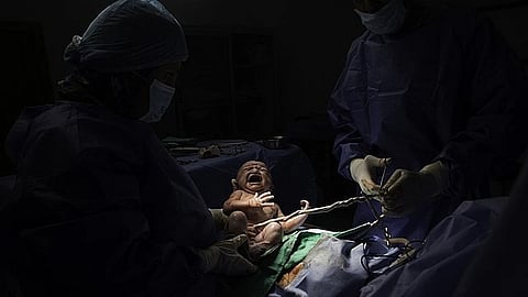 Cesarean section (C-section) procedures have increased dramatically around the world in the recent decades.
(Representational image: Wikimedia commons)