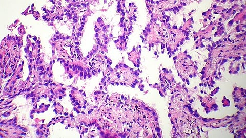 Messenger bubbles produced by human cells can pick up bacterial products and deliver them to other cells.
(Representational Image: Wikimedia Commons)