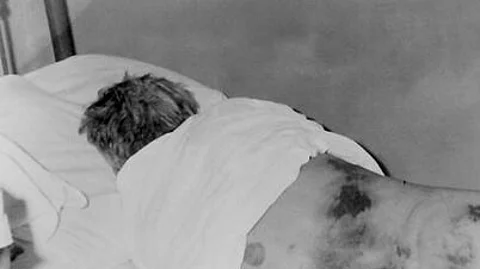 A young doctor lost his life while battling with the deadly Congo virus
(representational image: Wikimedia Commons)