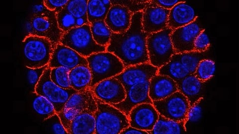 Cancer cell
(Representational Image :Unsplash)