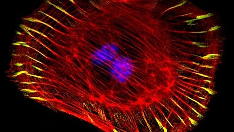 Researchers examined the effects of the accumulation of stepwise gene mutations on cell competition and investigated the role of cell competition in the actual cancer formation process.
(Representational image: Wikimedia commons)