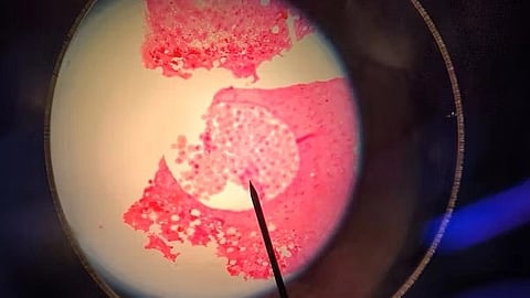 Estrogen receptor plays a critical role in endothelial cells to lower blood glucose (Representational Image :Unsplash)