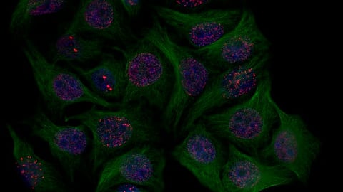 Cellular proteins twist and pull DNA, folding the genome into intricate 3D structures that support functioning of its coding parts (representational image: Wikimedia Commons).